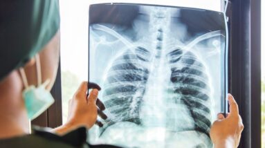 Lung cancer death rate sees significant decline in Canada