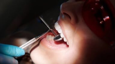 One in four Canadians skip the dentist due to cost: report