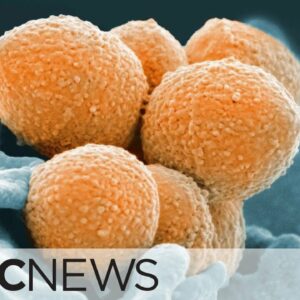 Invasive cases of Group A strep soar to record levels