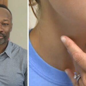 Doctor shares symptoms to watch out for in potentially 'life-threatening' strain of strep throat