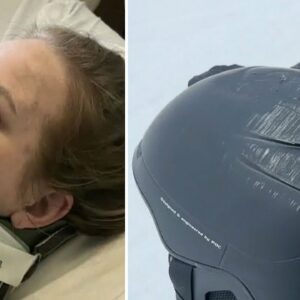 Woman on her recovering life-changing ski accident | Helmet saves woman's life